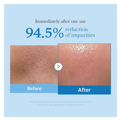 Medicube Zero Pore Blackhead Cleansing Oil 205ml