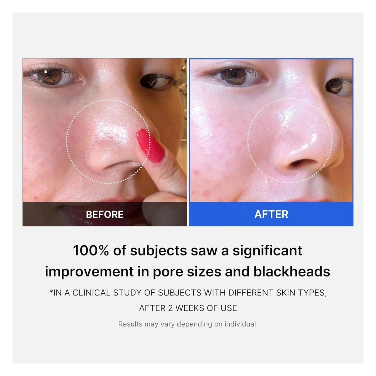 Medicube Zero Pore Pad 155g (AHA/BHA)