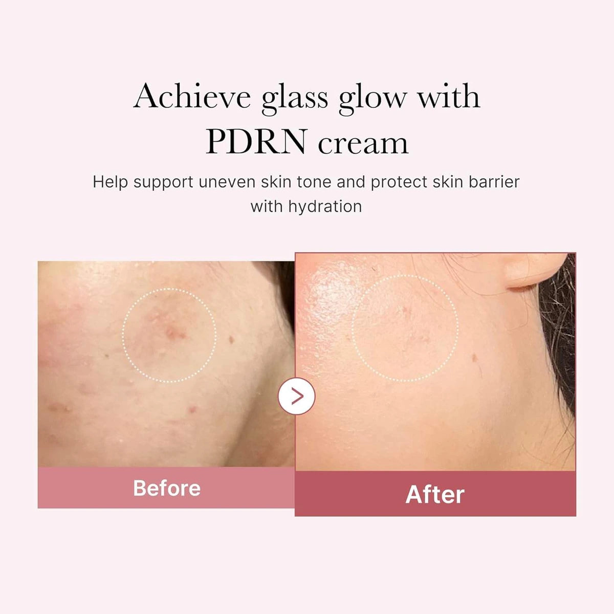 Medicube Pink Hyaluronic Water Cream 50ml