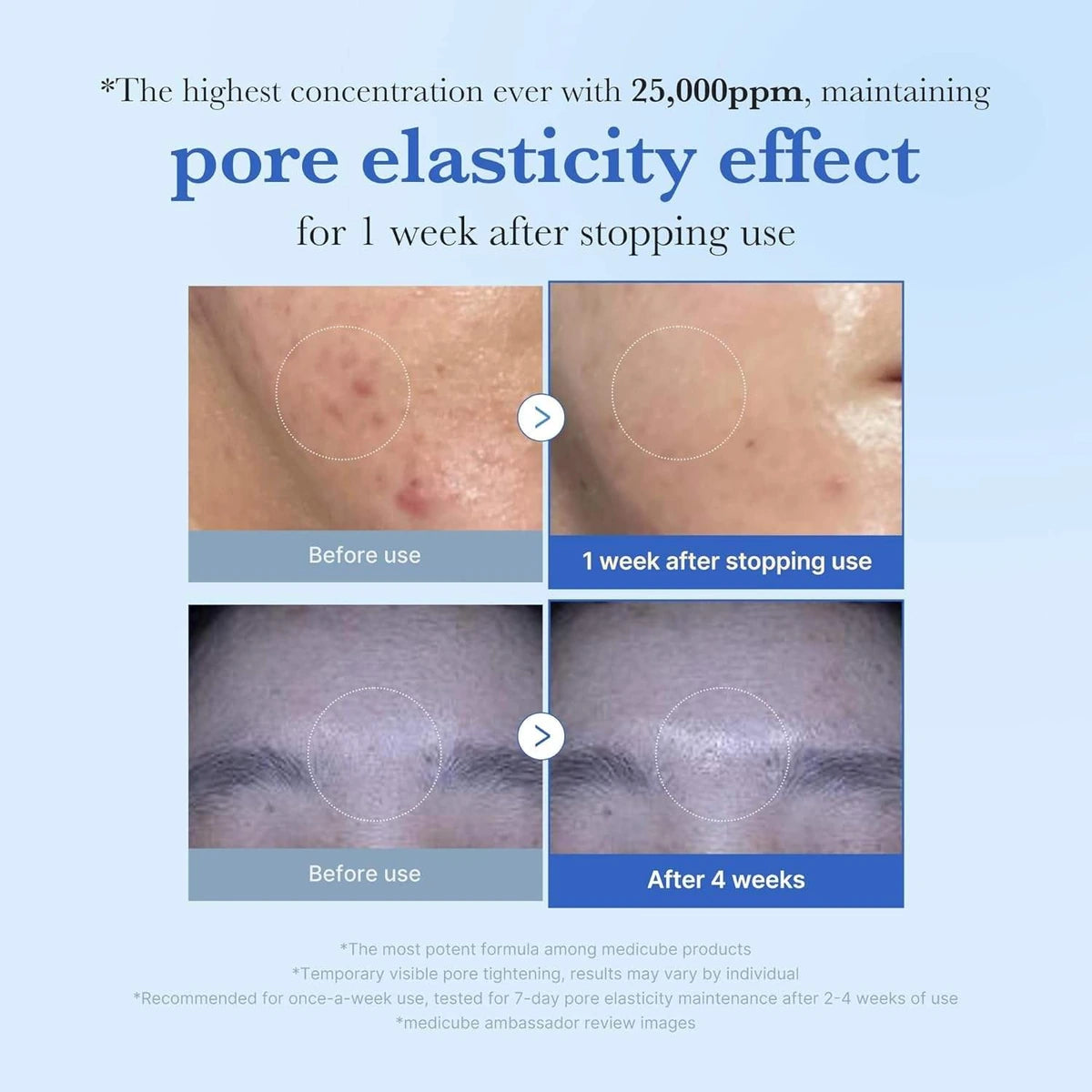 Medicube Zero PDRN 25,000 PPM Bone Needle Facial Serum